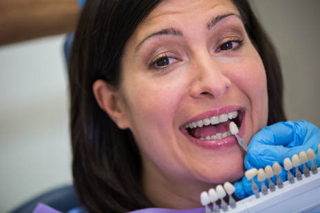 Implanti Dentali Singoli